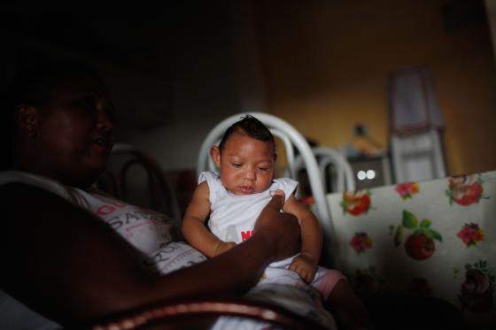 Birth Defects from the Zika Virus